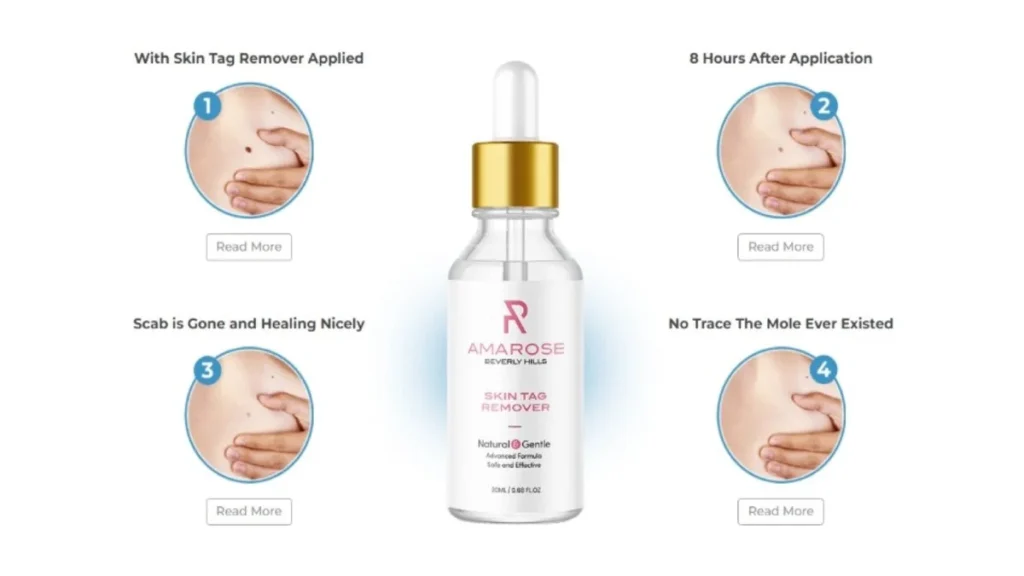 Amarose Skin Tag Remover Revealed The Secret to Clear and Beautiful Skin 2