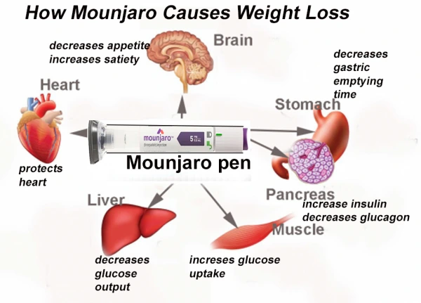 The Optimal Location for Administering Best Place to Inject Mounjaro for Weight Loss in the Upcoming Year 2024
