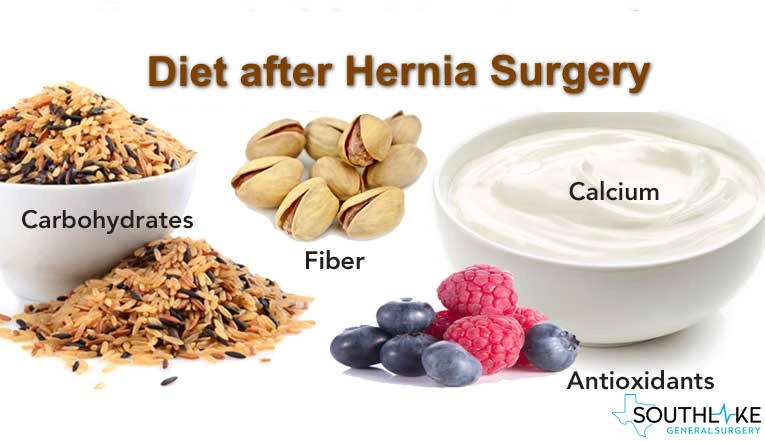 Navigating Diet and Weight Loss After Hiatal Hernia Surgery: A Comprehensive Guide to Better Treatment and Health in 2024